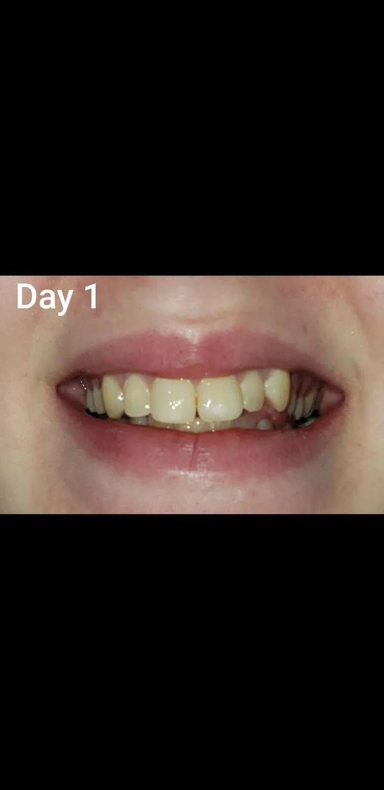 27564 natural gentle approach