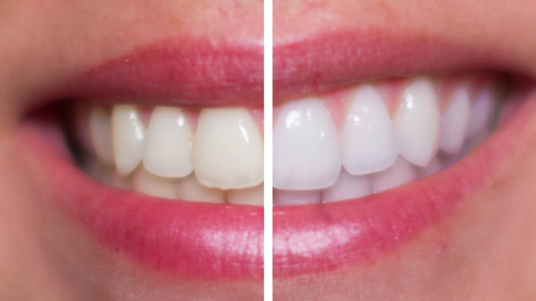 27566 affordable teeth whitening solutions