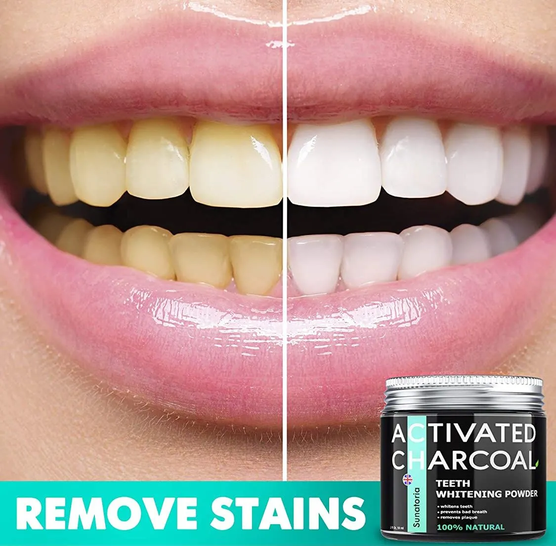 27571 teeth whitening products boots overview