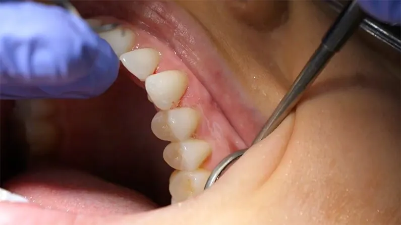 27575 dentist consultation