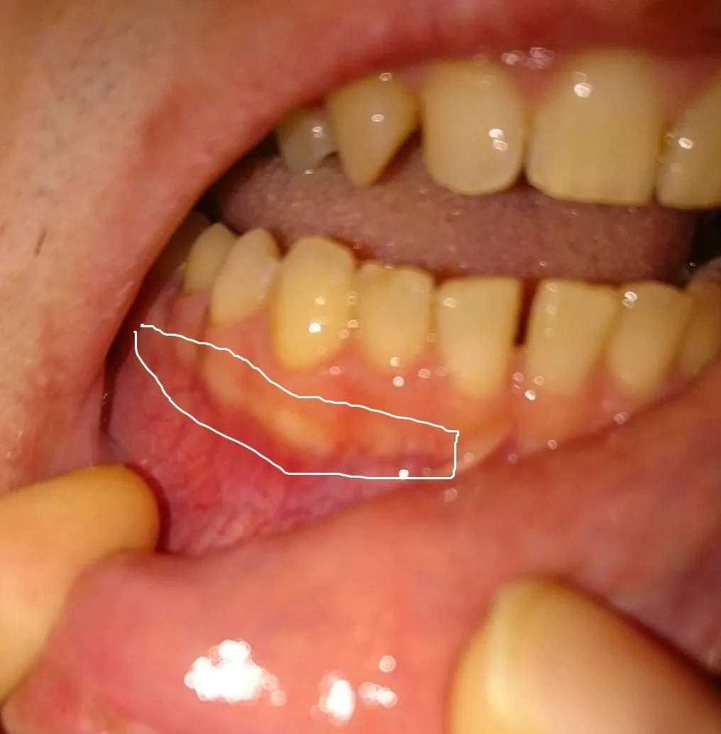 27575 whitening methods