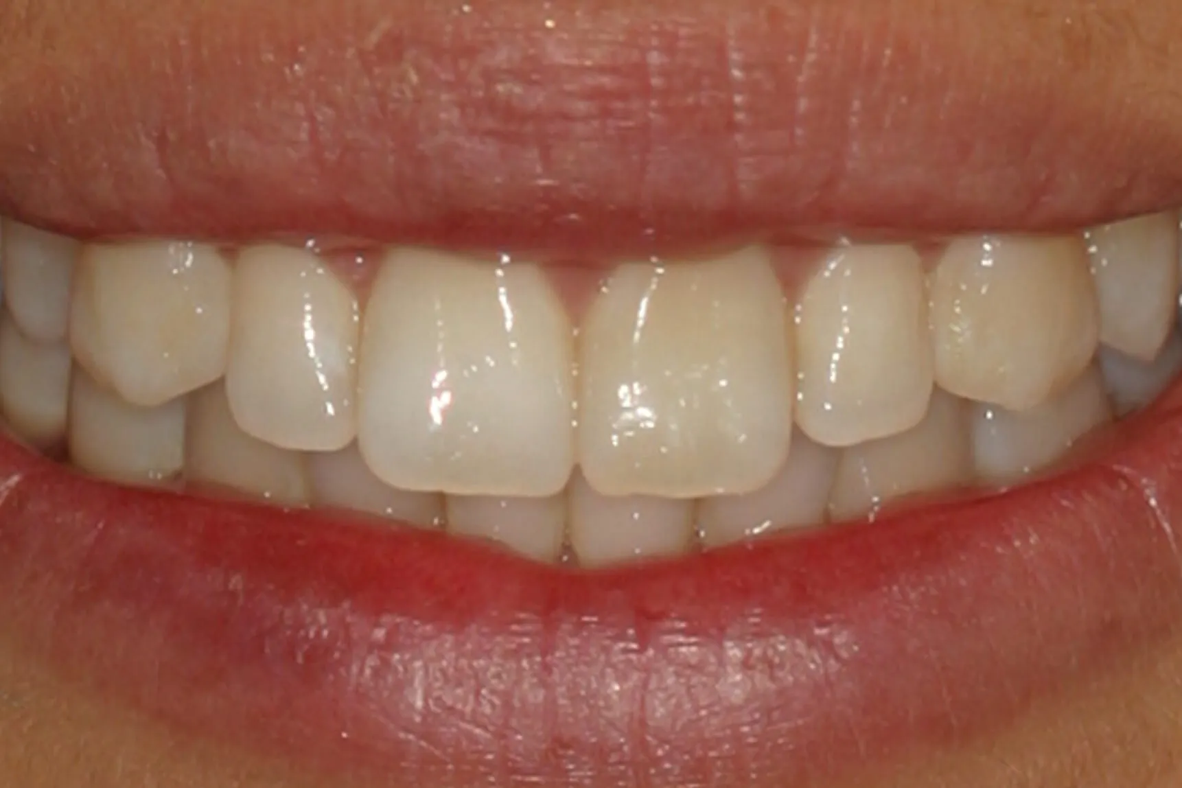 /img/27585-dental-professional-teeth-whitening.webp