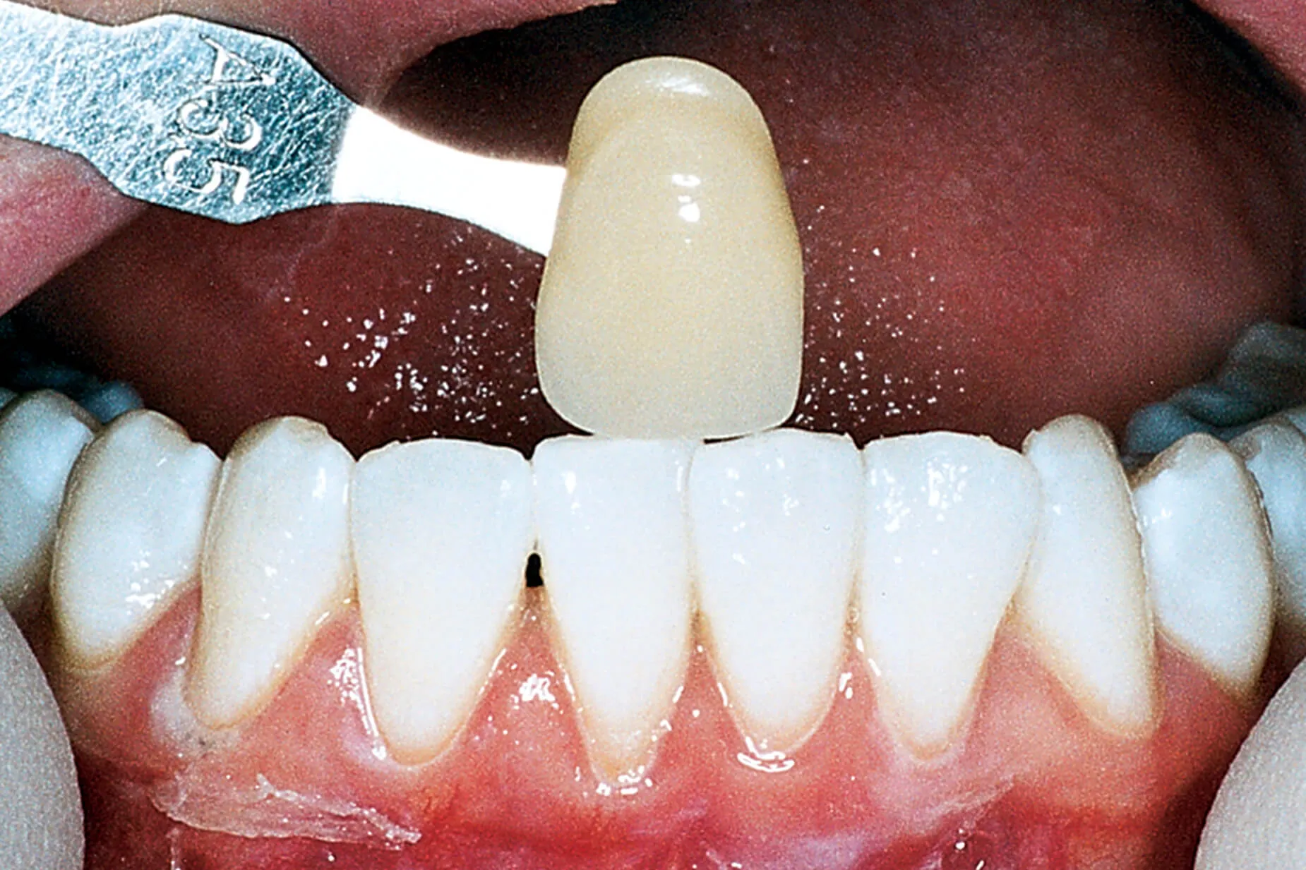 27585 teeth whitening foods drinks