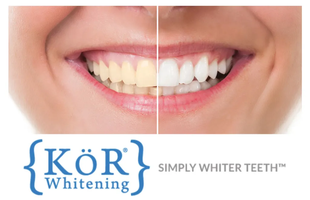 27585 teeth whitening gel application