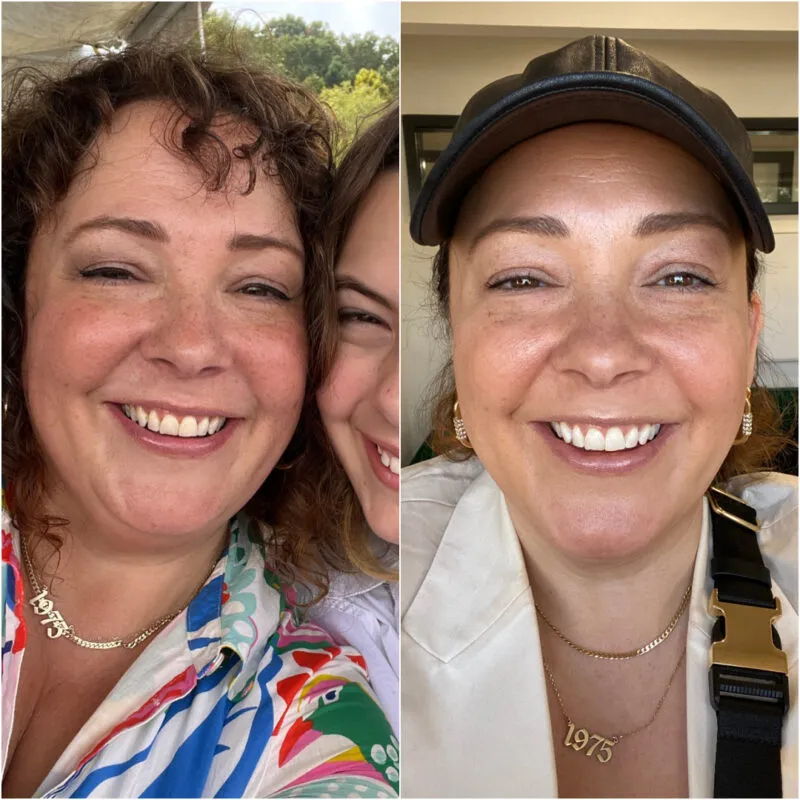 27592 gum irritation