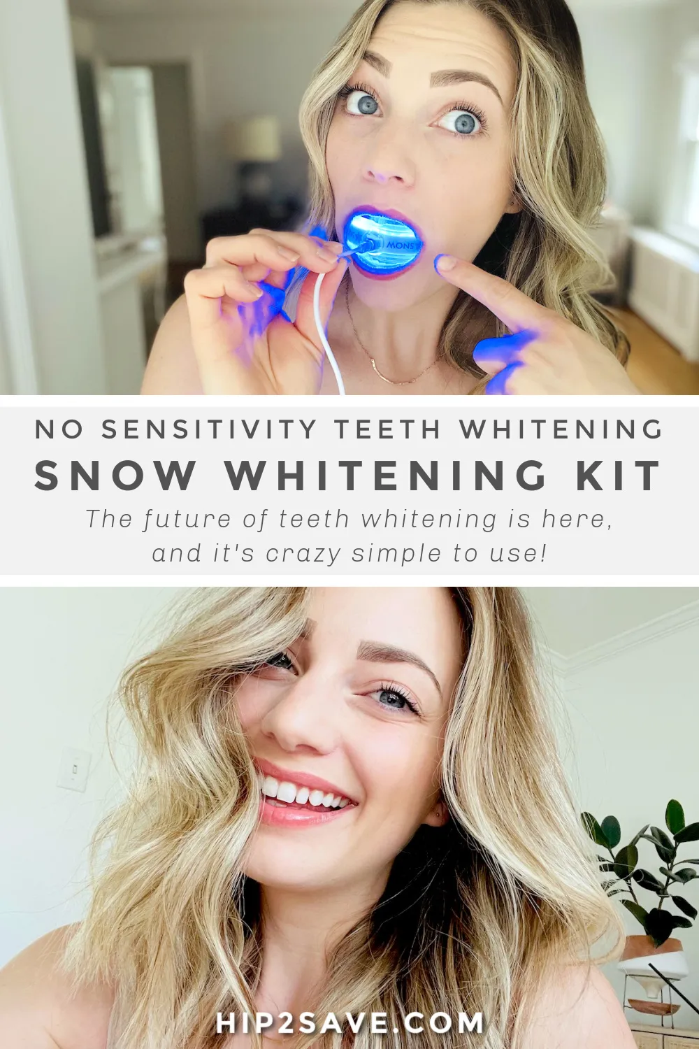 27592 professional teeth whitening