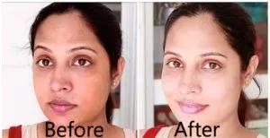 27596 skin whitening alternatives