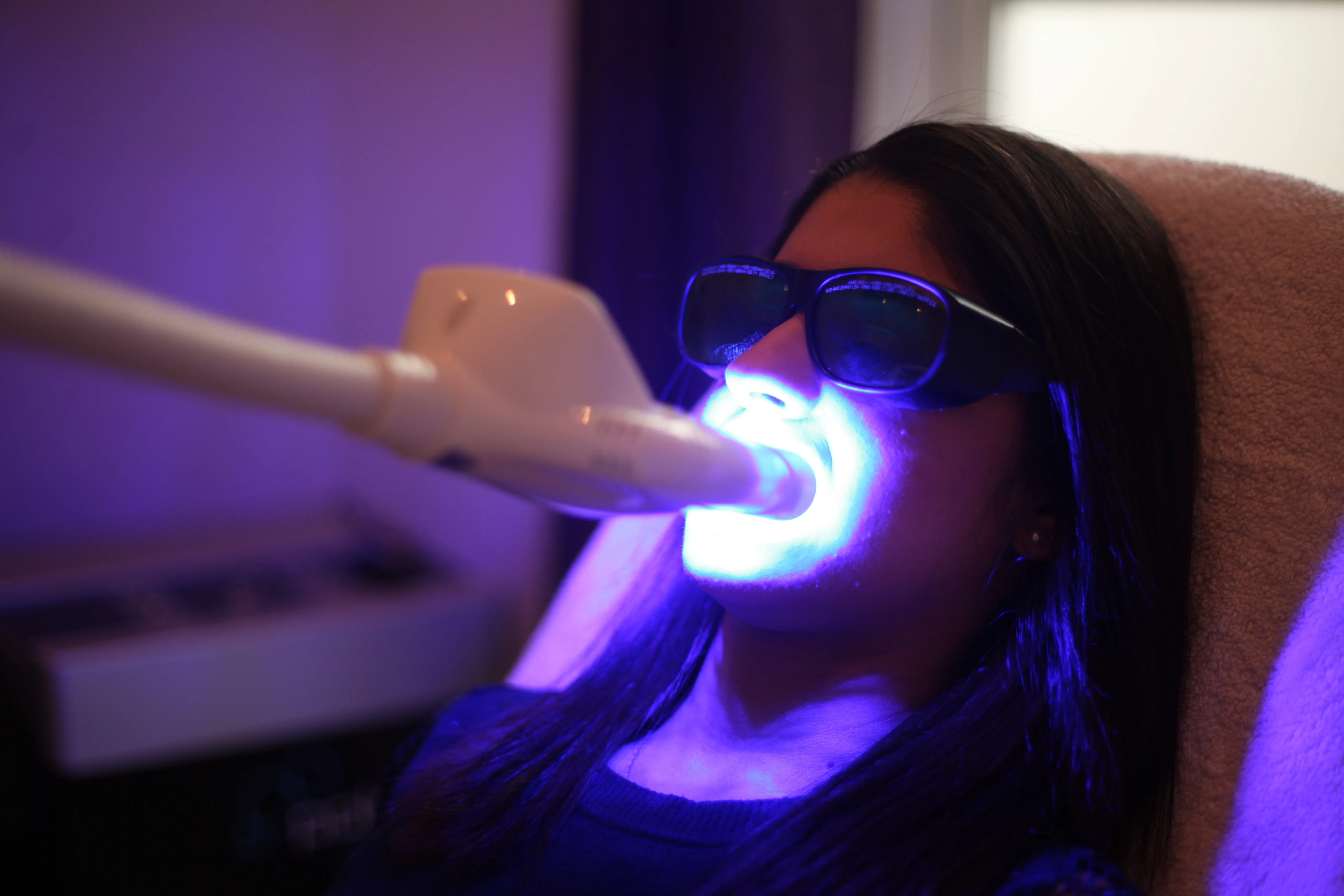 27597 causes of teeth discoloration