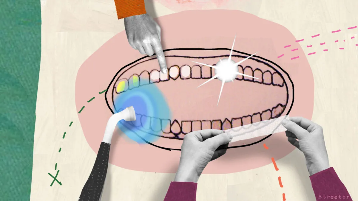 27605 marketing teeth whitening