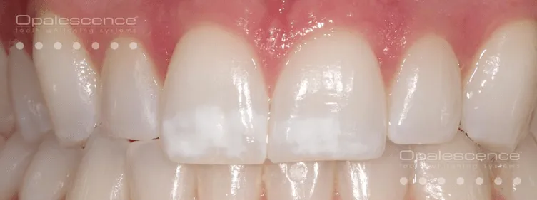 27609 oral hygiene routine