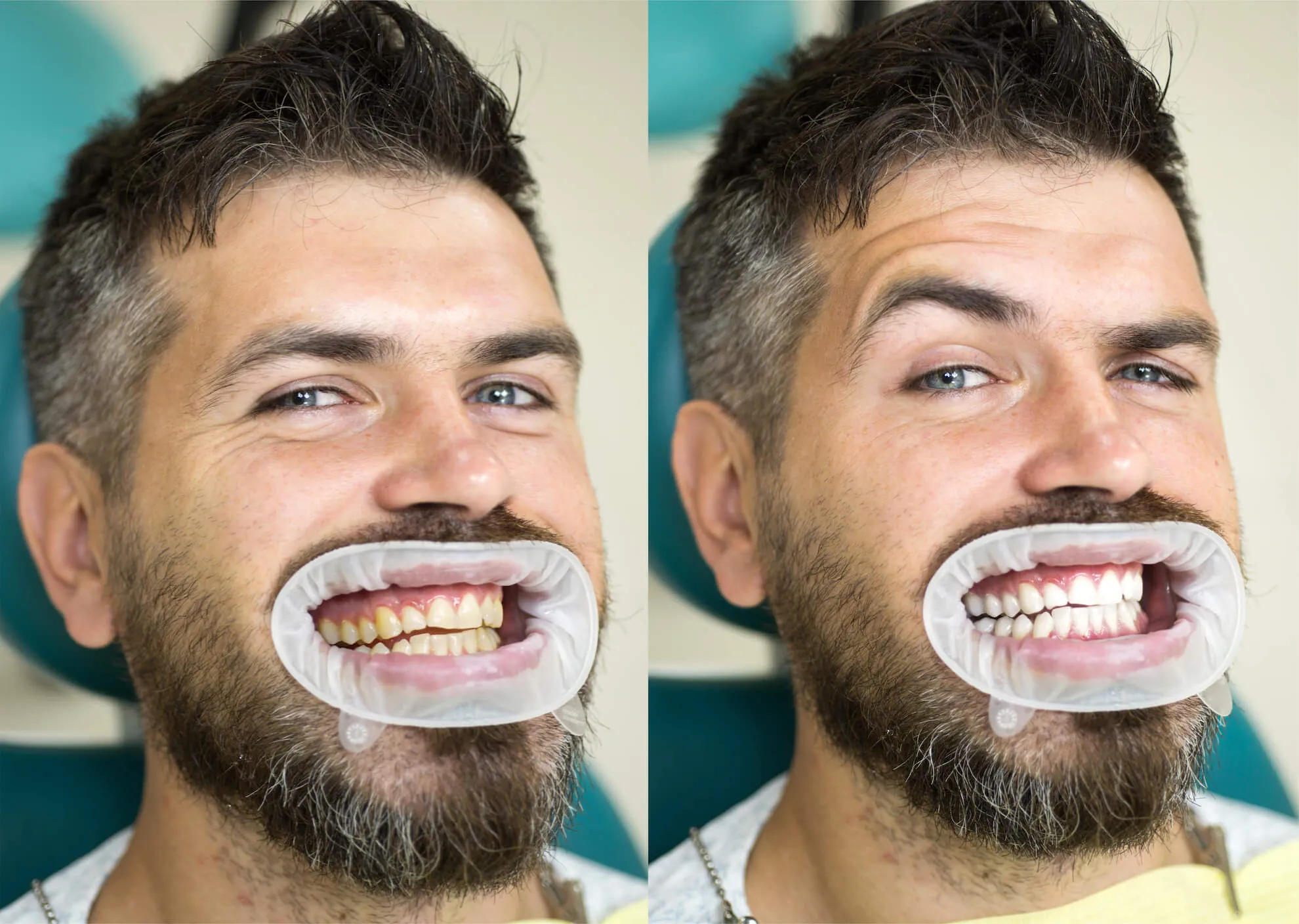 /img/27612-teeth-whitening-nh-happy-patient.webp