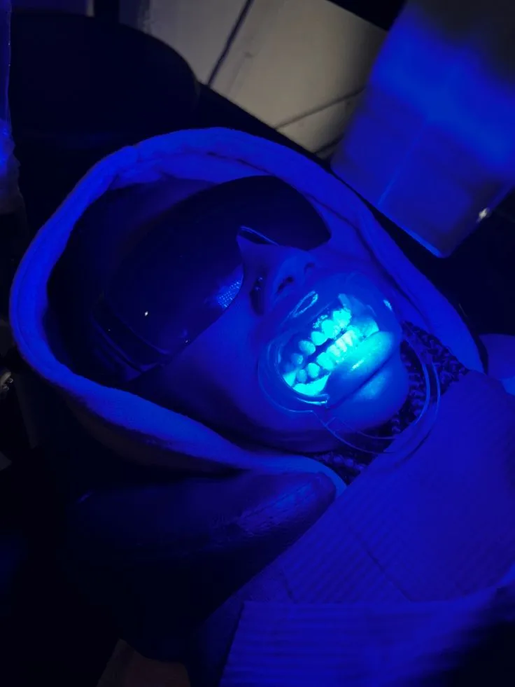 27622 in office teeth whitening