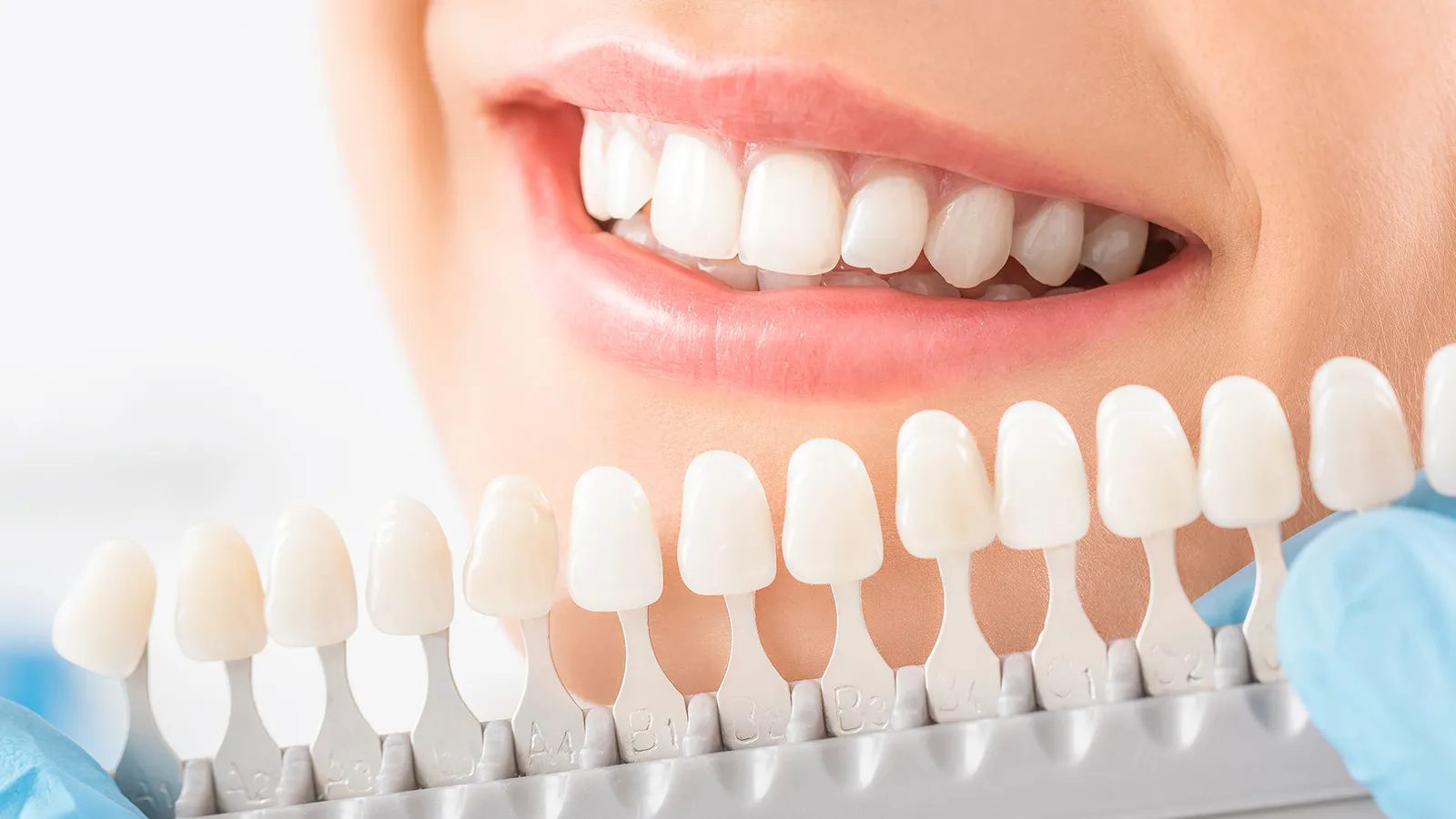27622 teeth whitening consultation