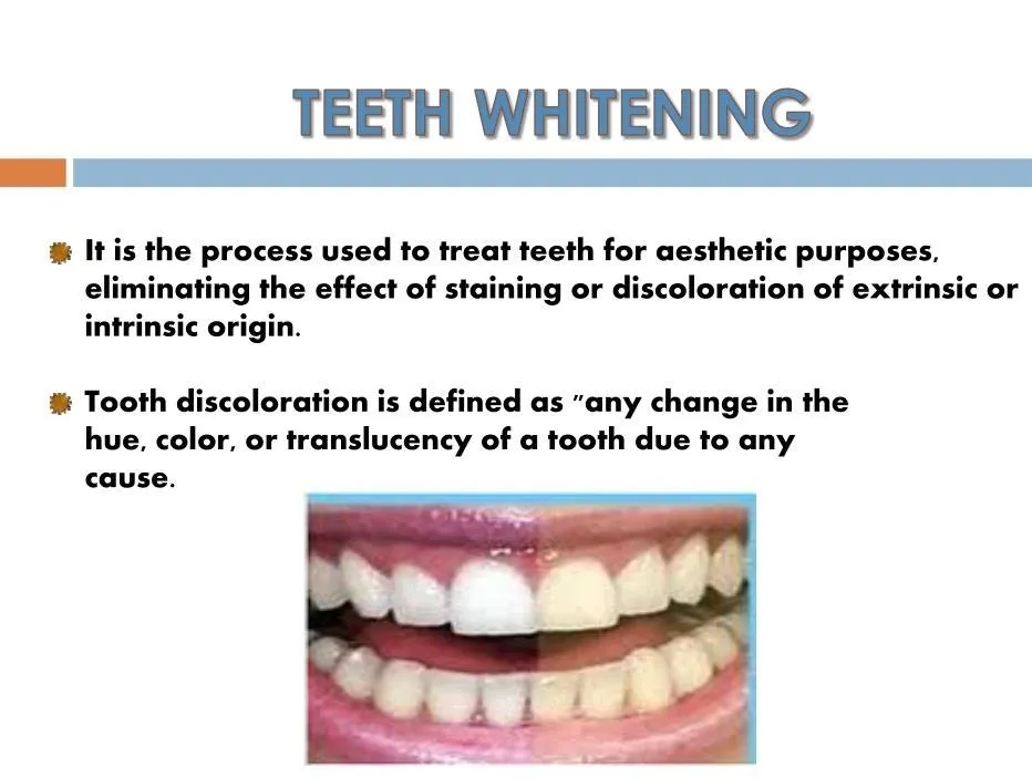 27622 teeth whitening procedure