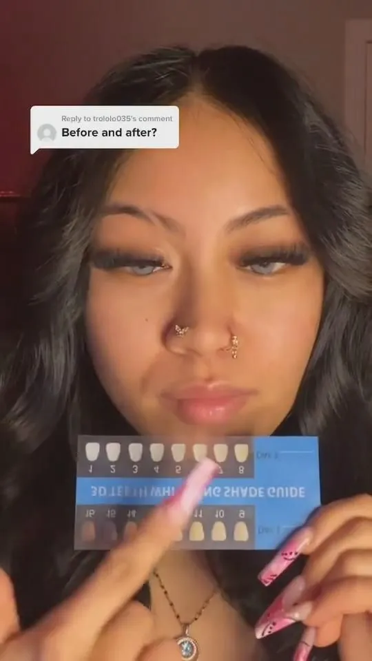 27628 applying whitening strips