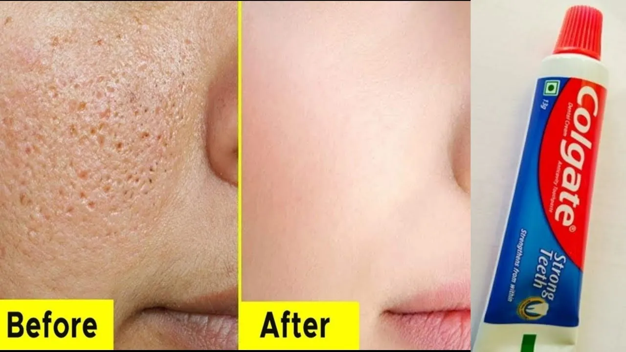 27634 bleaching process hair 4