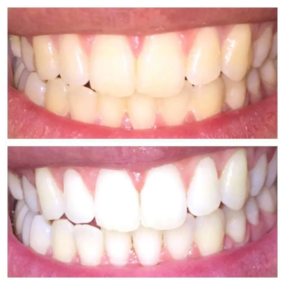 27634 hydrogen peroxide hair 3