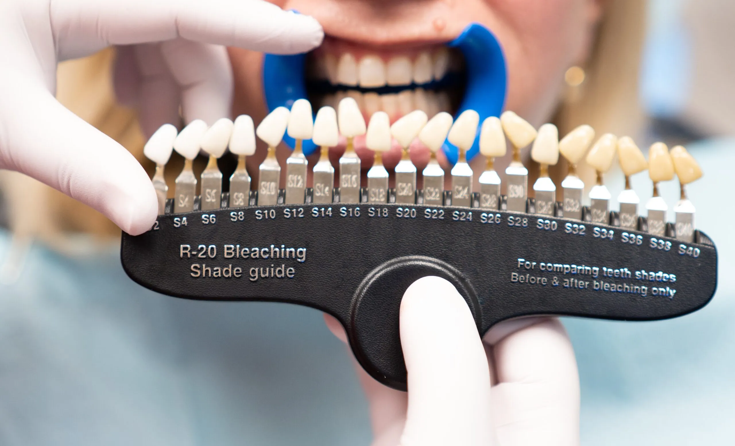 27644 teeth whitening milpitas ca confident smile