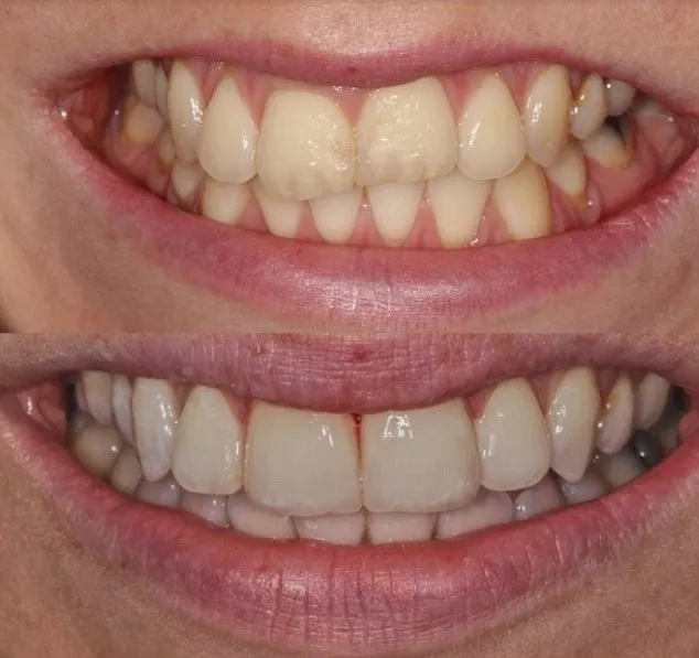 27650 healthy gums