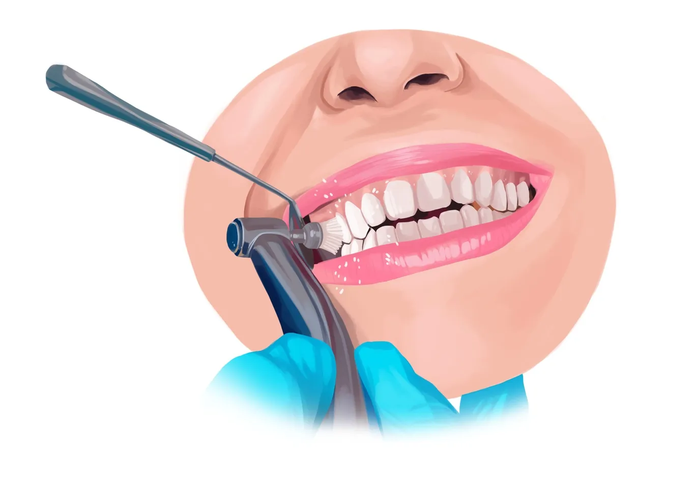 27651 teeth whitening procedures