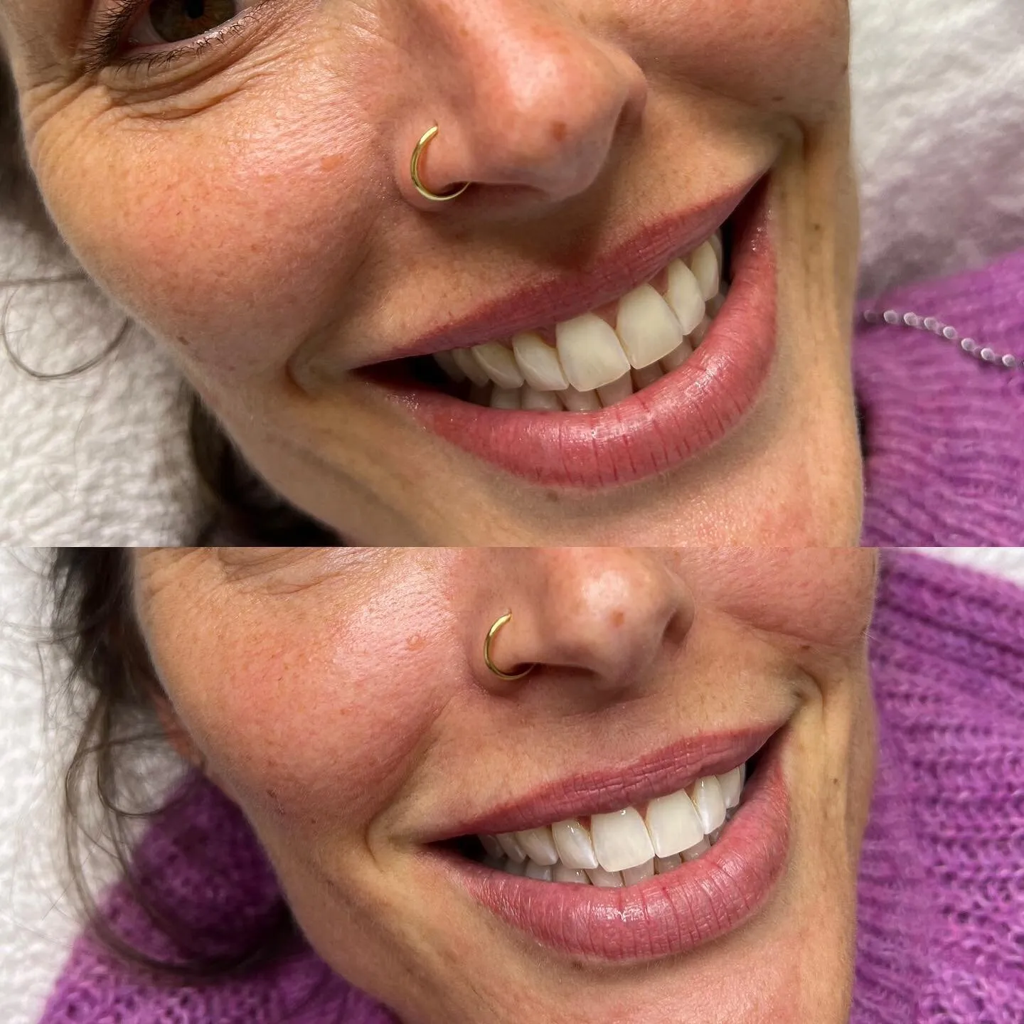 27663 nuvawhite product