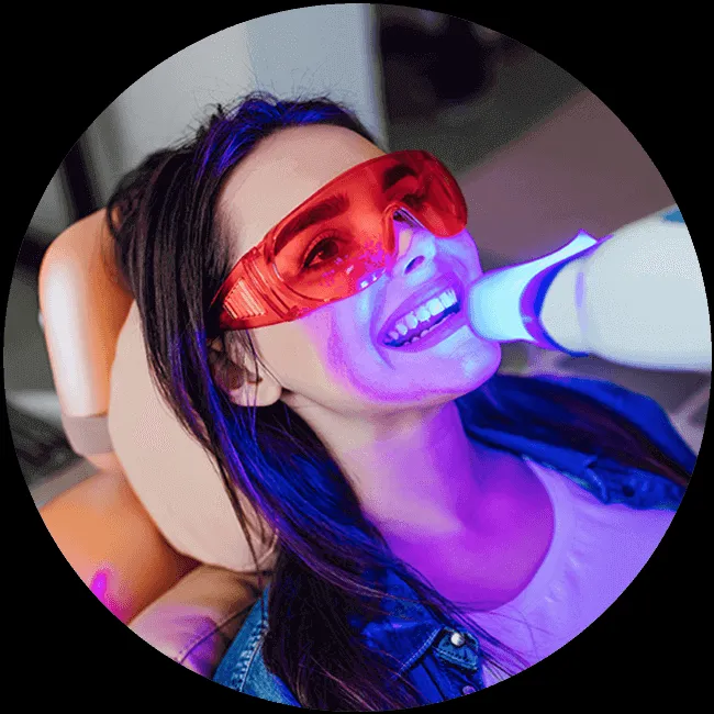 27667 teeth whitening temecula ca image2