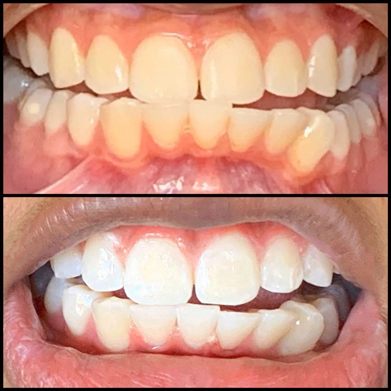 27667 teeth whitening temecula ca image7