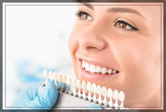27668 in office teeth whitening
