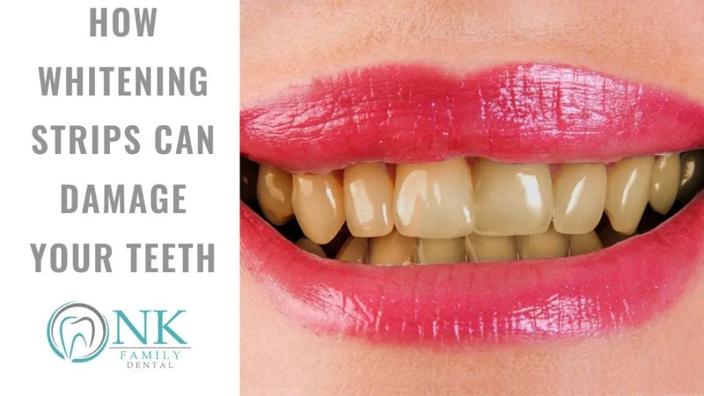 27674 teeth whitening process