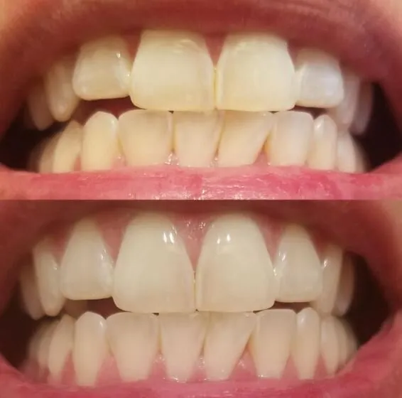 27676 avoiding staining foods