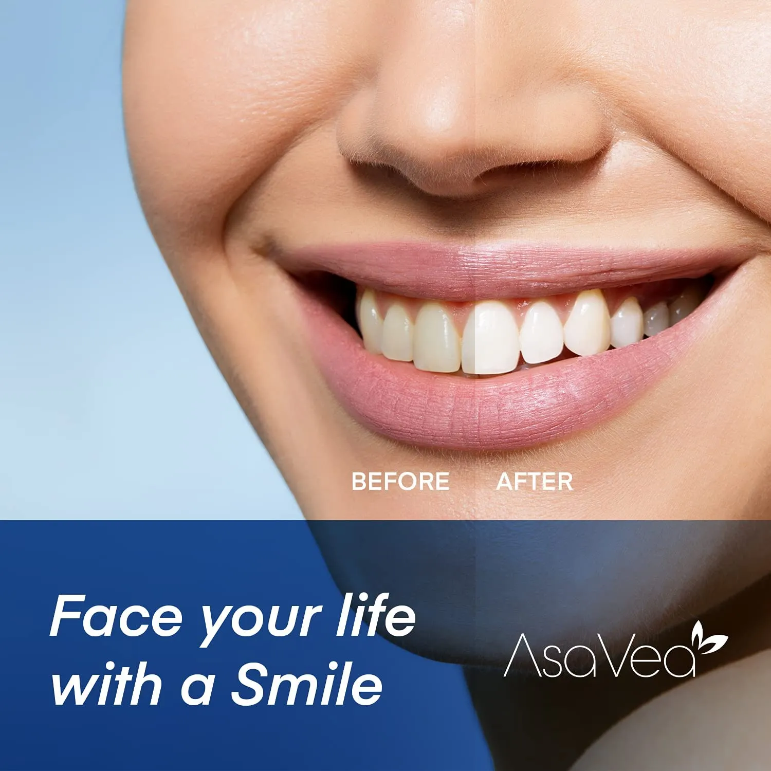 27676 teeth whitening before after