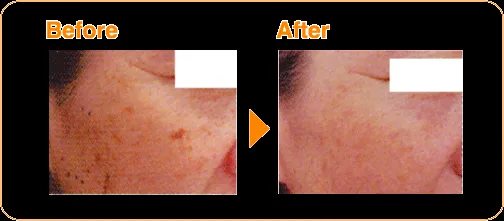 27687 healthy diet skin