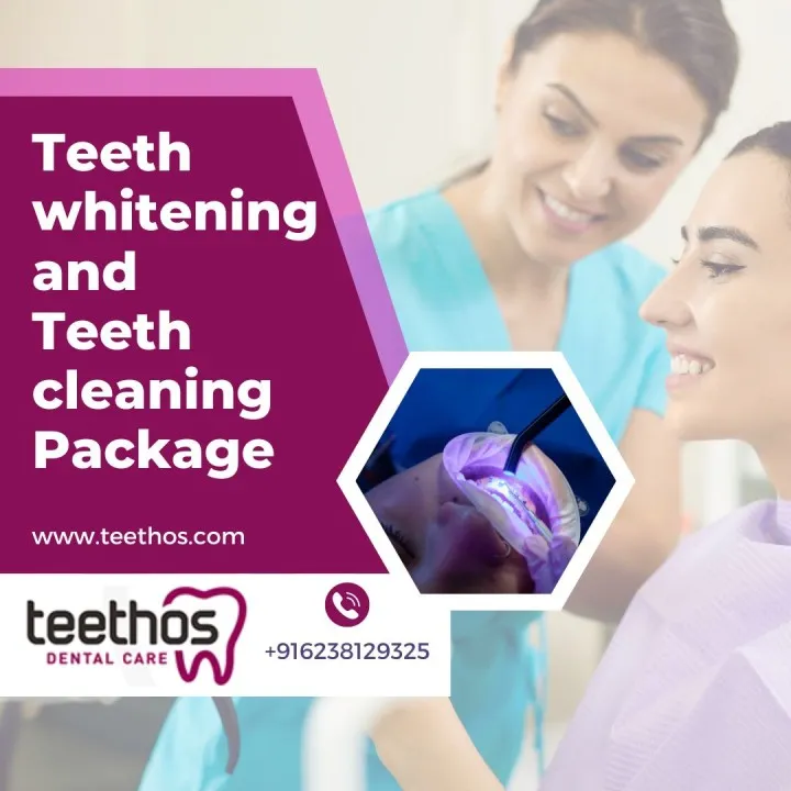 27697 at home whitening