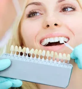 27703 in office teeth whitening