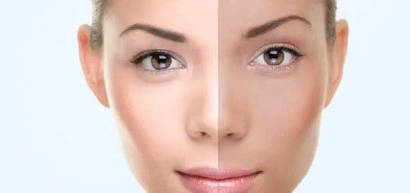 27718 skin whitening comparison