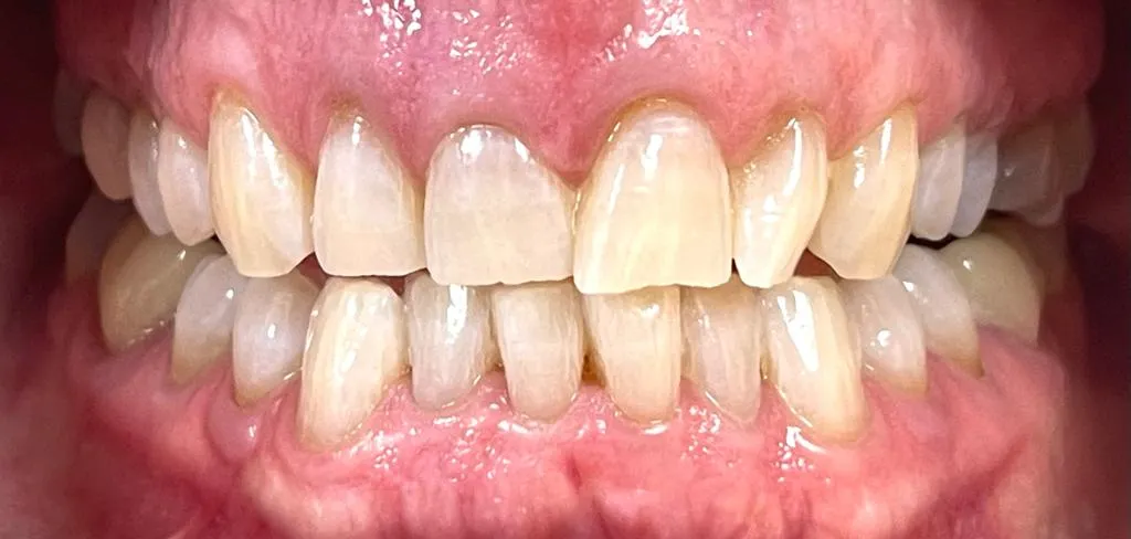 27723 pain management