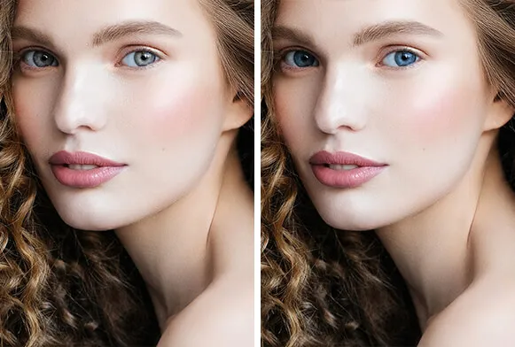 27731 teeth whitening action applied