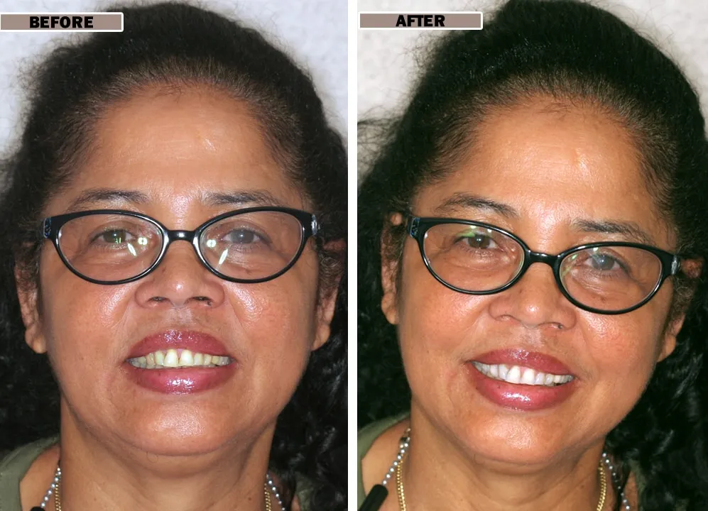 27737 healthy diet for teeth