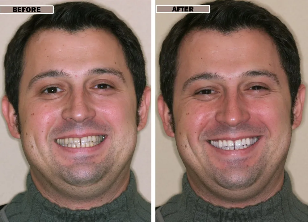 27737 regular dental checkups