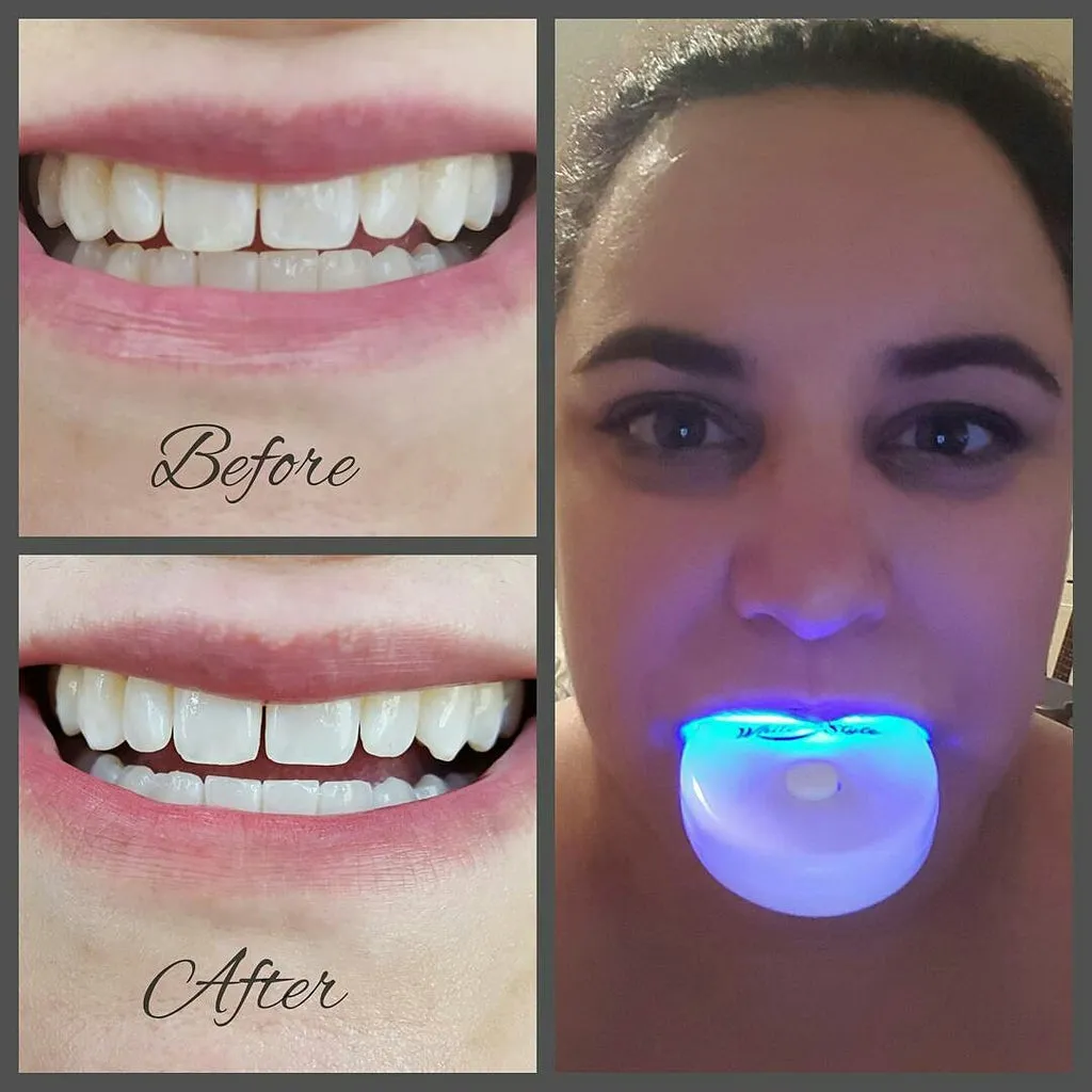 27747 avoid staining foods