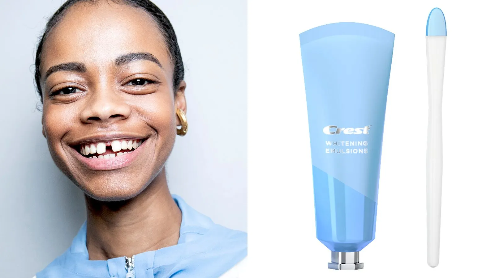 27760 teeth whitening results