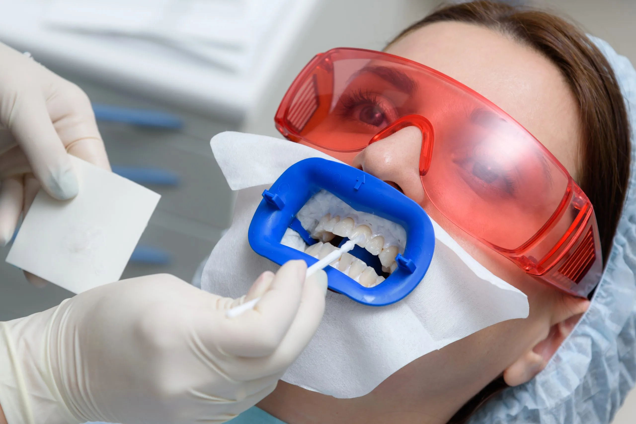 27766 take home whitening kit