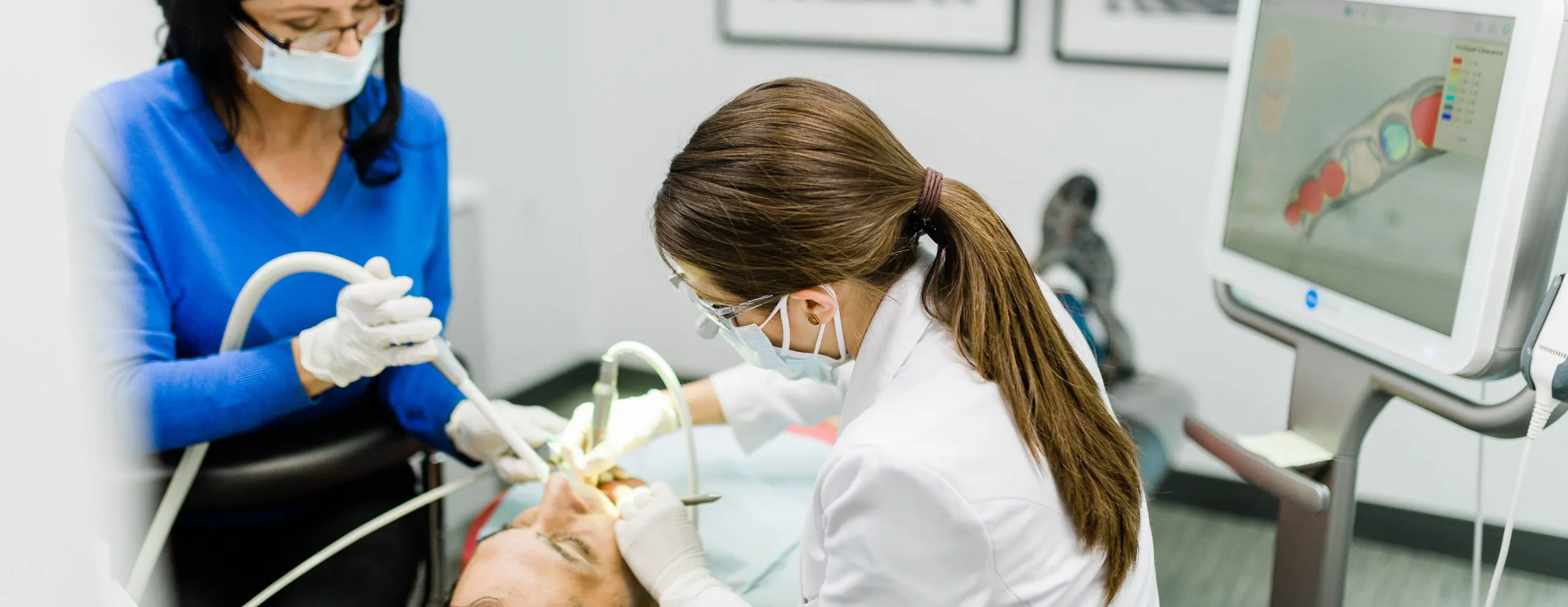 27766 teeth whitening results