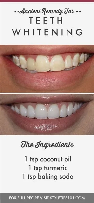 27770 sensitive toothpaste