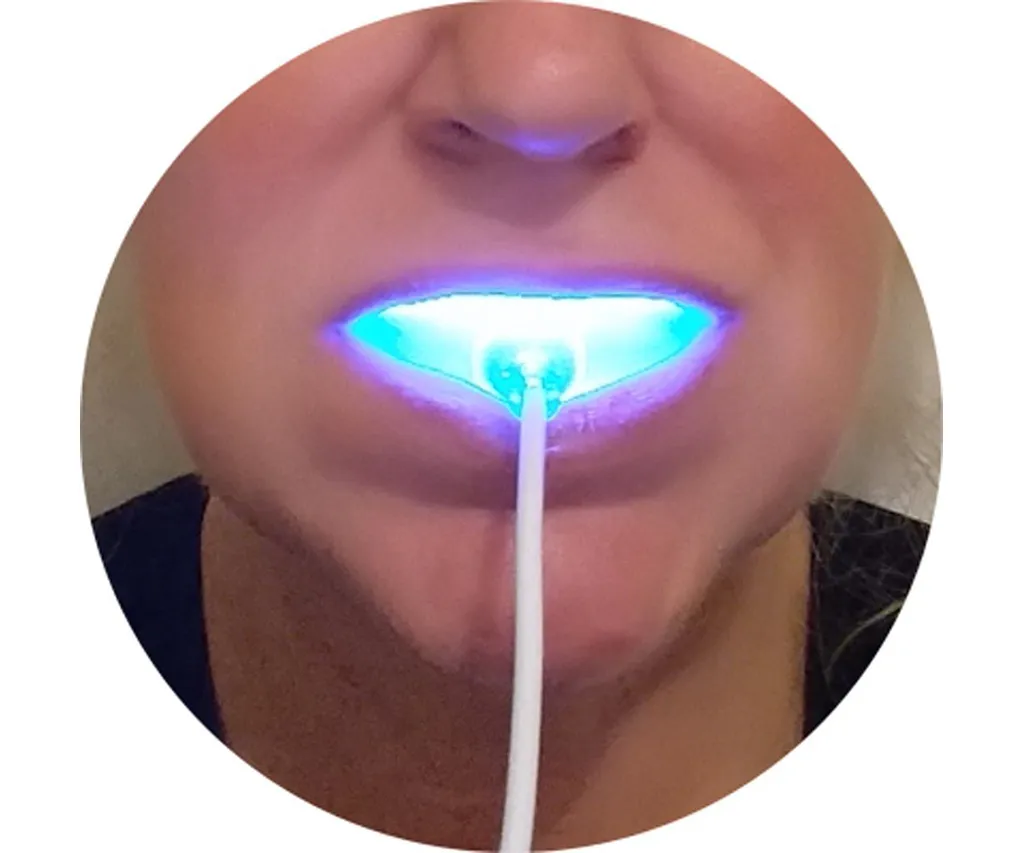 27774 teeth whitening light before after