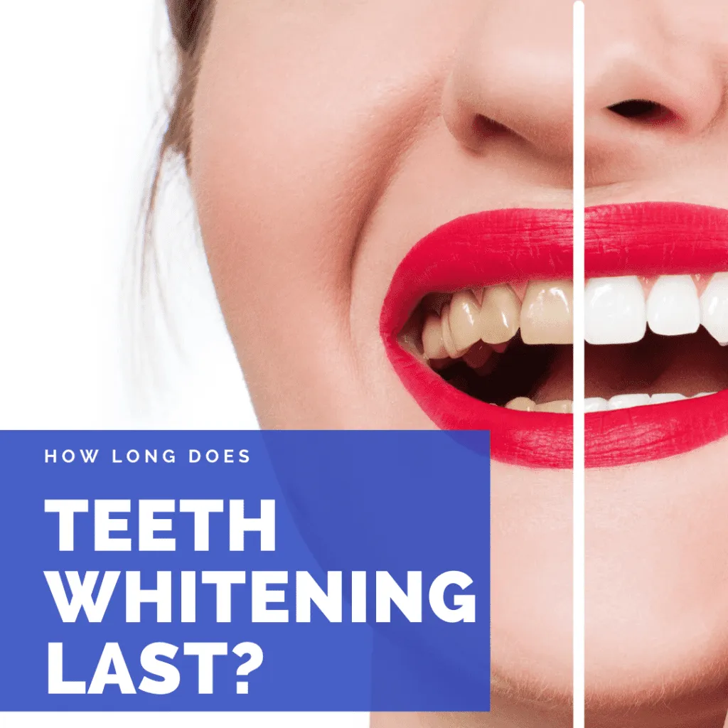 27776 factors influencing whitening