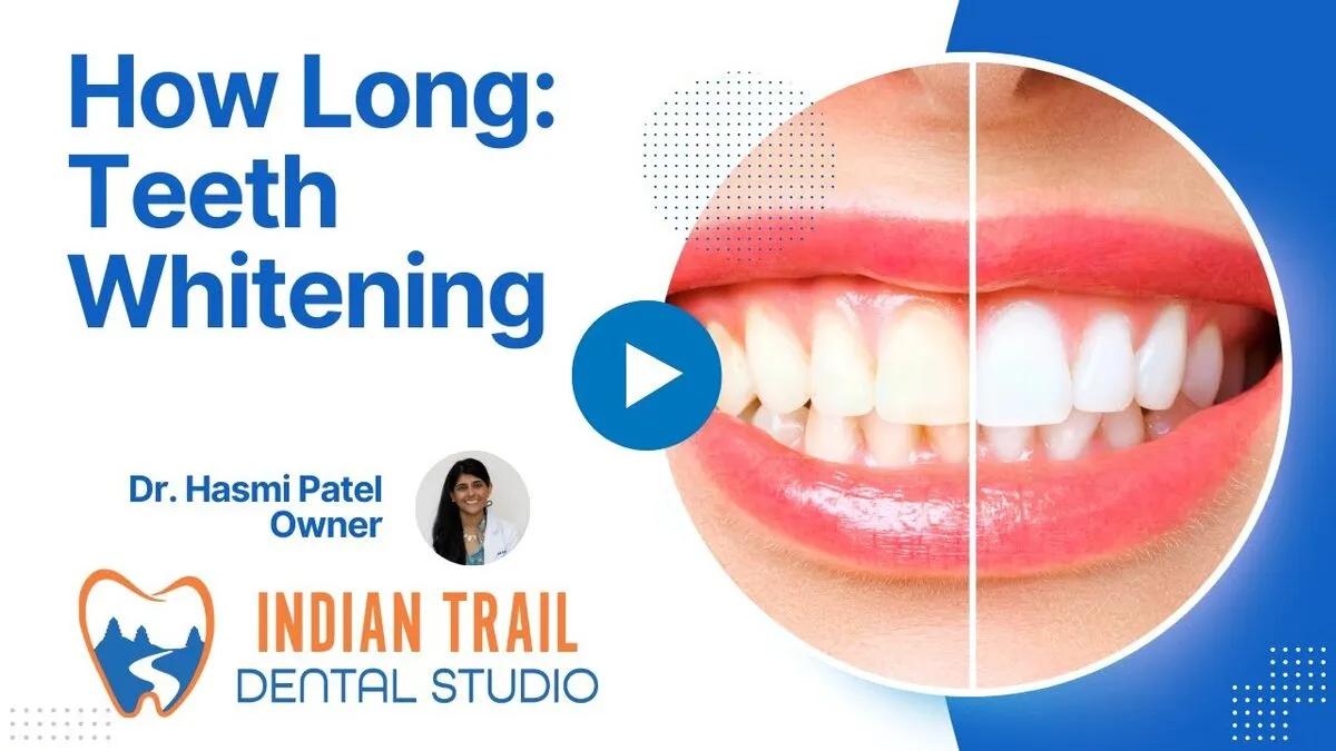 27776 types dental whitening