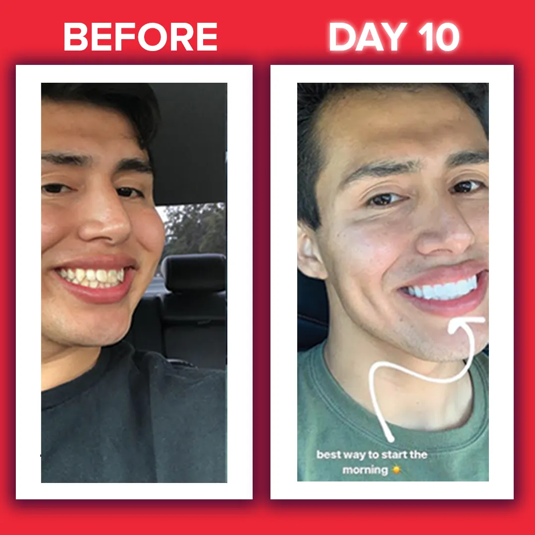 27778 stained food and drinks