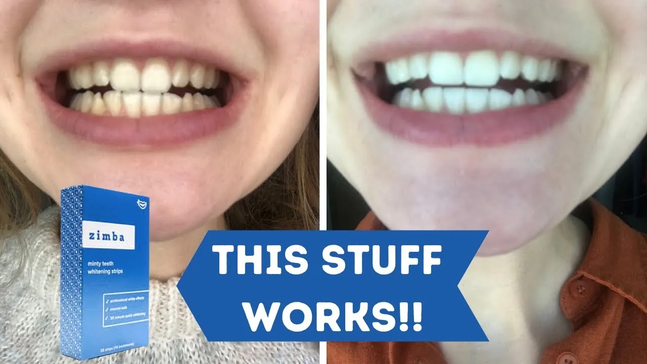 27778 teeth whitening process