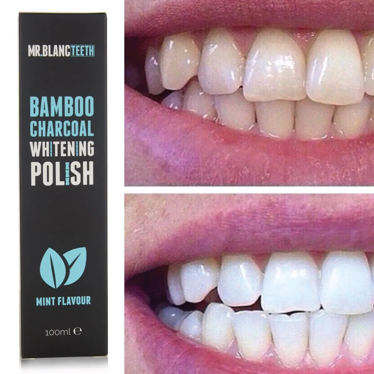 27787 teeth whitening user reviews